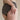 ¿La celulitis duele? Causas y cómo aliviar las molestias - Masderm Cosmética