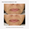RF Facial Cream - Masderm Cosmética