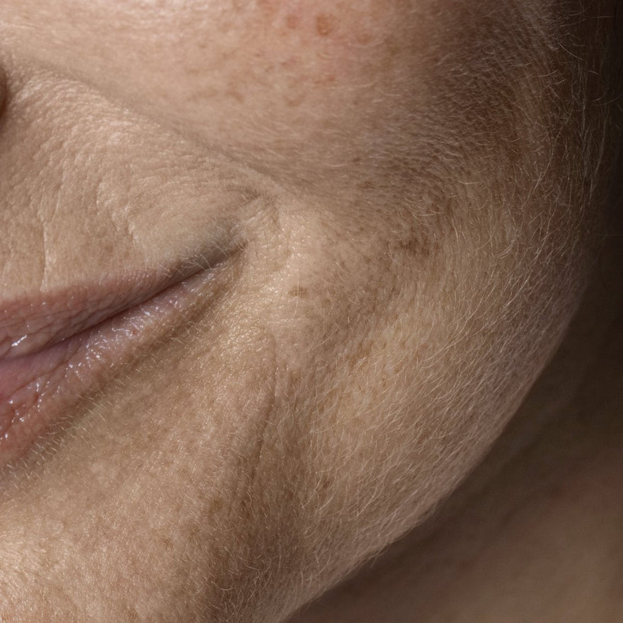 ¿Cómo recuperar una piel envejecida por la edad u otros factores? - Masderm Cosmética