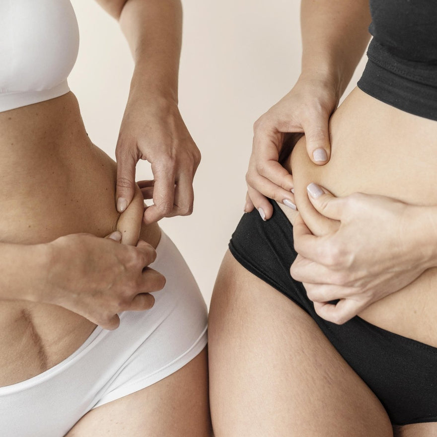 Radiofrecuencia en el abdomen: el tratamiento para reducir el exceso de grasa - Masderm Cosmética