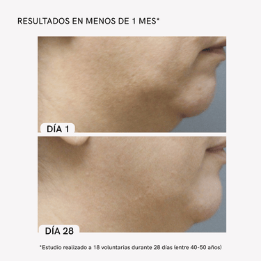 Neck Rejuvenation Device - Masderm Cosmética