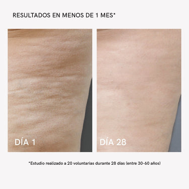 RF Body Device - Masderm Cosmética