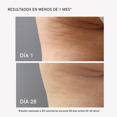 RF Body Slim - Masderm Cosmética