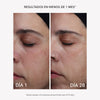 RF Eyemas Patch - Masderm Cosmética