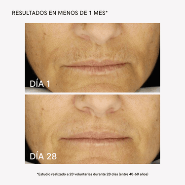 RF Face Device - Masderm Cosmética