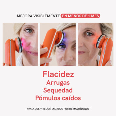 RF Face Device - Masderm Cosmética