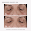 RF Face Device Plus - Masderm Cosmética