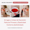 RF Tratamiento Antiarrugas Contorno de Ojos - Masderm Cosmética