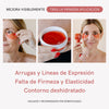 RF Tratamiento Antiarrugas Contorno de Ojos Avanzado - Masderm Cosmética