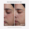 RF Tratamiento Antiarrugas y Reafirmante Contorno de Ojos Plus - Masderm Cosmética