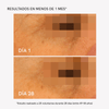 RF Tratamiento Contorno de Ojos Intensivo - Masderm Cosmética