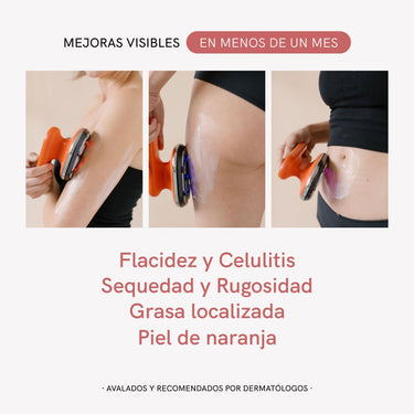 RF Tratamiento Corporal Completo - Masderm Cosmética