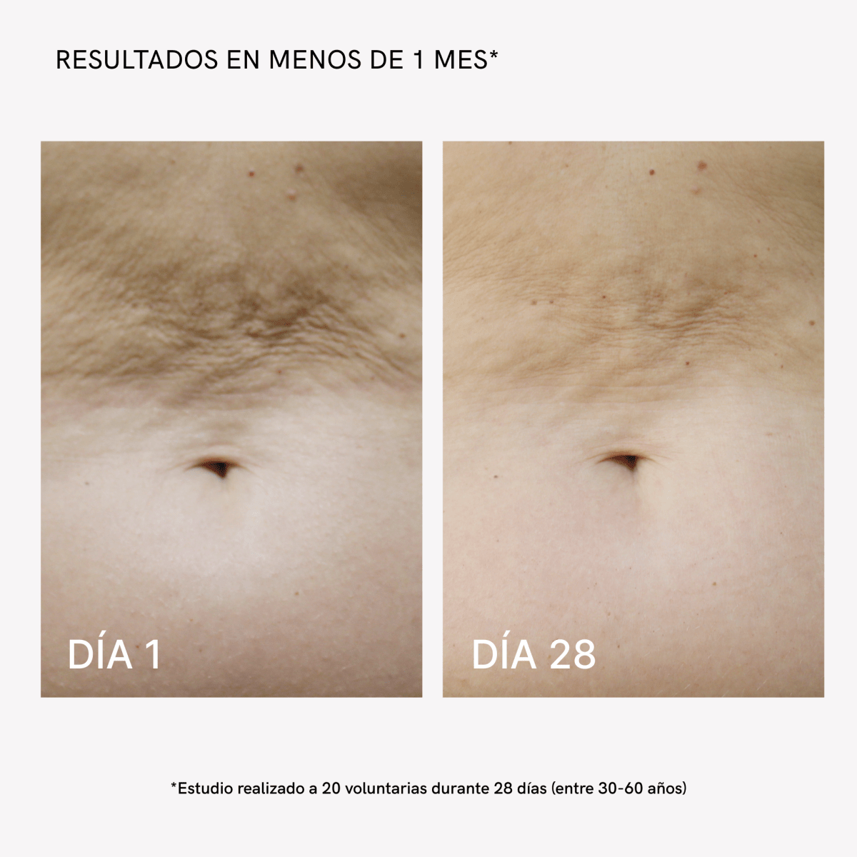 Masderm device modes