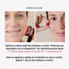 RF Tratamiento Flacidez y Arrugas - Masderm Cosmética