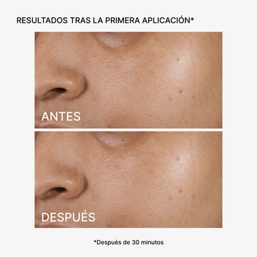 RF Tratamiento Hidratación y Firmeza Facial - Masderm Cosmética